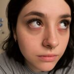 Eye hurts when I blink and pain in eye when blinking